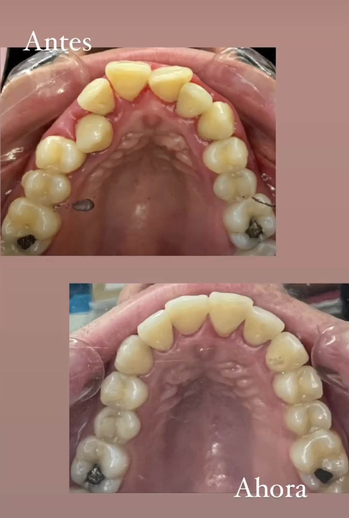 Sonrisa real y resultados estéticos naturales
